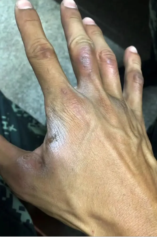 牵女朋友的手" 但,田添鸿仍然感到很自豪 "如果虎口上没有几处老茧 没